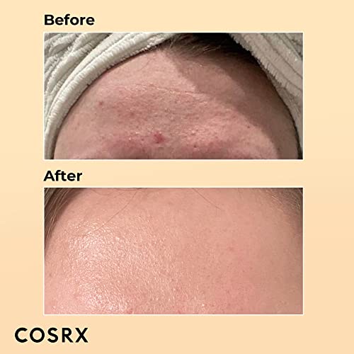 COSRX Advanced Snail 96% Mucin Power Essence 100ml, Gesichtsserum mit Schneckenschleim und Hyaluron hochdosiert, für unreine und empfindliche Haut, Anti Pickel, tierversuchsfrei, Korean Skincare