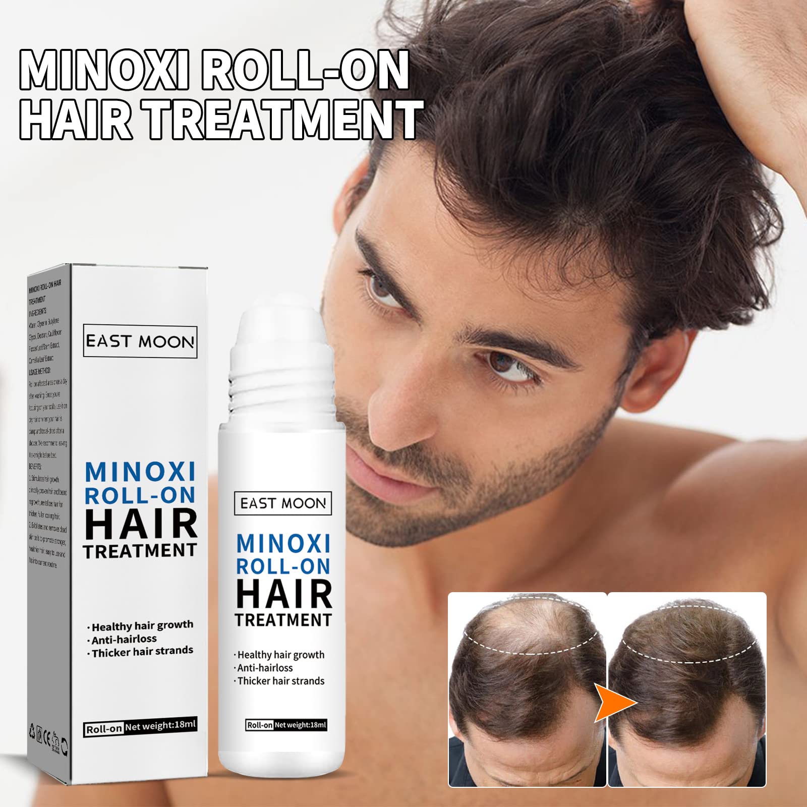 2PCS ScalpRevive Min_oxidil Growth Roller,Roll-on Haarkur Haarwachstumsserum,Min_oxidil Roll-on Haarkur zum Aufrollen,Natürliches Pflegendes Haar Scalp Öl für Frauen & Männer,Serum für Haarausfall